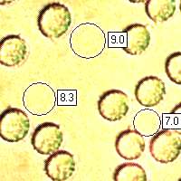Spores of Laccaria proxima - Scurfy Deceiver