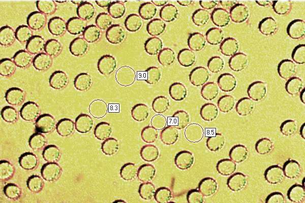 Spores of Laccaria proxima