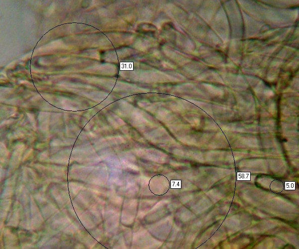 Pileipellis of Cuphophyllus pratensis