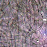 Gill trama of Cuphophyllus pratensis - Meadow Waxcap