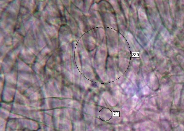 Gill trama of Cuphophyllus pratensis