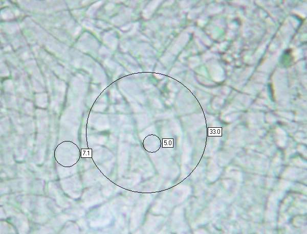 Gill trama of Cuphophyllus virgineus