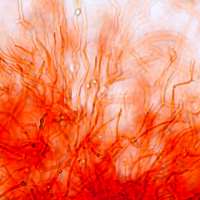 The pileipellis of Gliophorus irrigatus