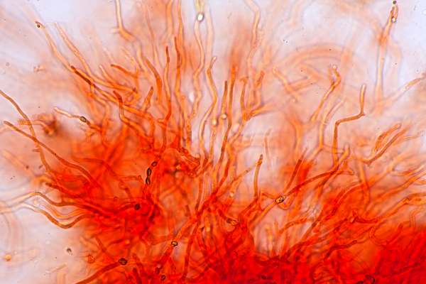 Pileipellis of Gliophorus irrigatus