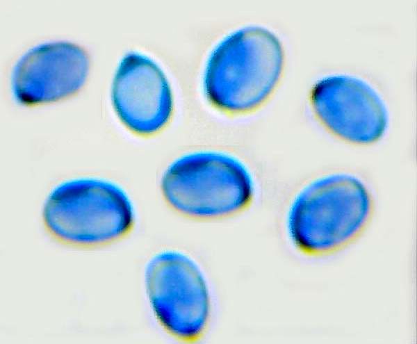Paraphyses of Gliophorus irrigatus