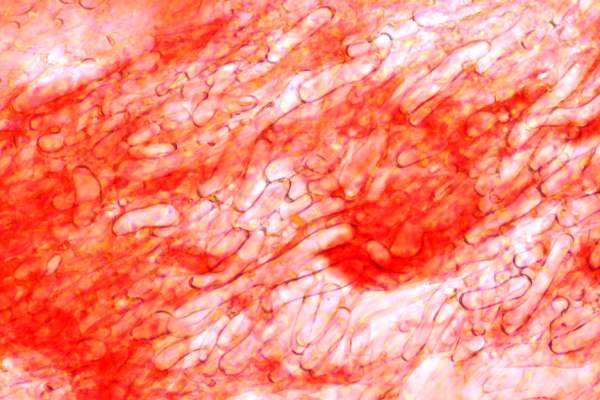 Gill trama of Gliophorus irrigatus