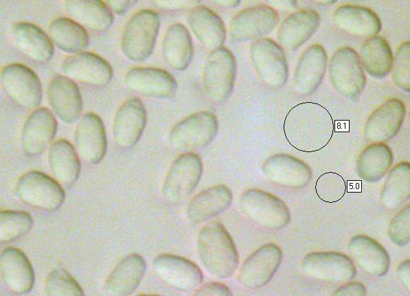 Gill trama of Gliophorus psittacinus