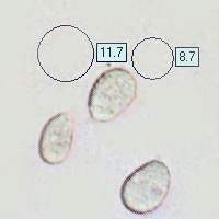 Spores of Hygrocybe acutoconica var konradii