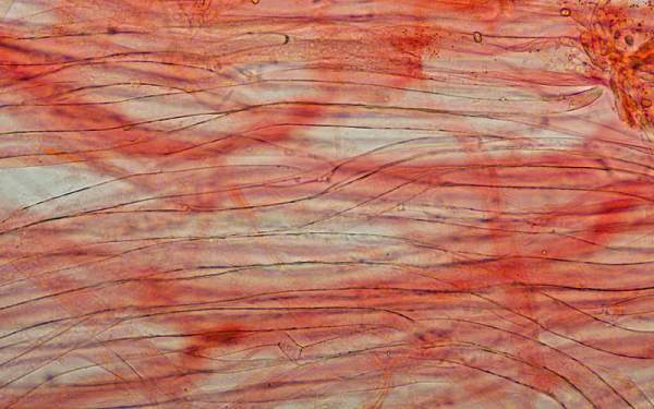 Gill trama of Hygrocybe chlorophana