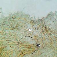 Pileipellis of Hygrocybe coccinea