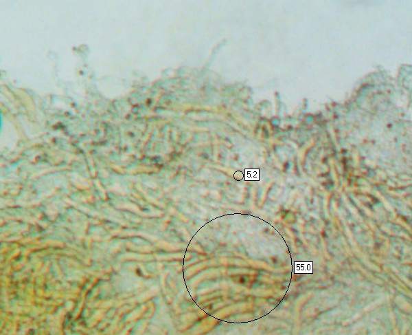 Pileipellis of Hygrocybe coccinea