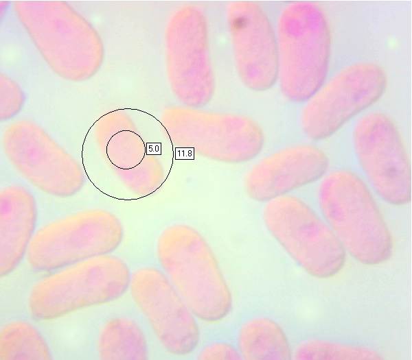 Spores of Hygrocybe conica