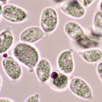 Spores of Hygrocybe helobia