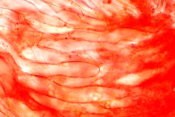 Gill trama of Hygrocybe miniata