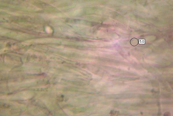 Pileipellis of Hygrocybe quieta