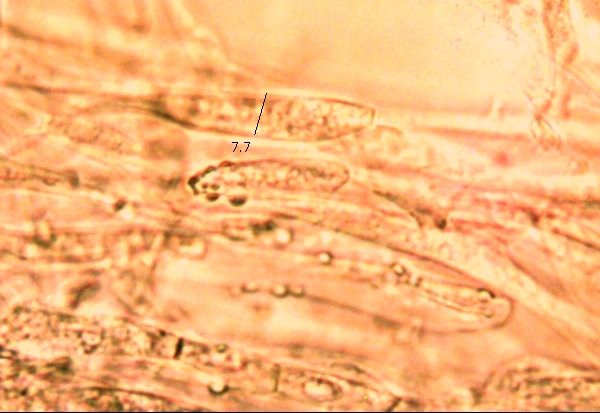 Pileipellis of Hygrocybe substrangulata