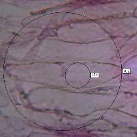 Pileipellis of Porpolomopsis calyptriformis