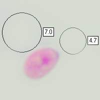 Spores of Porpolomopsis calyptriformis