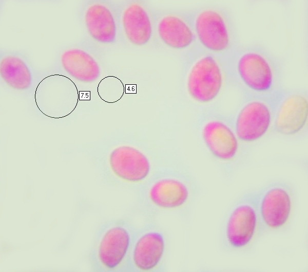 Spores of Porpolomopsis calyptriformis