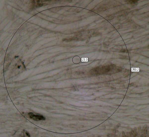 Gill trama of Porpolomopsis calyptriformis