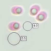 Spores of Fuscoporia torulosa