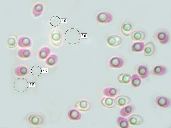 Spores of Fuscoporia torulosa