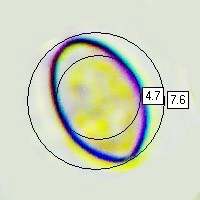 Spores of Crepidotus mollis