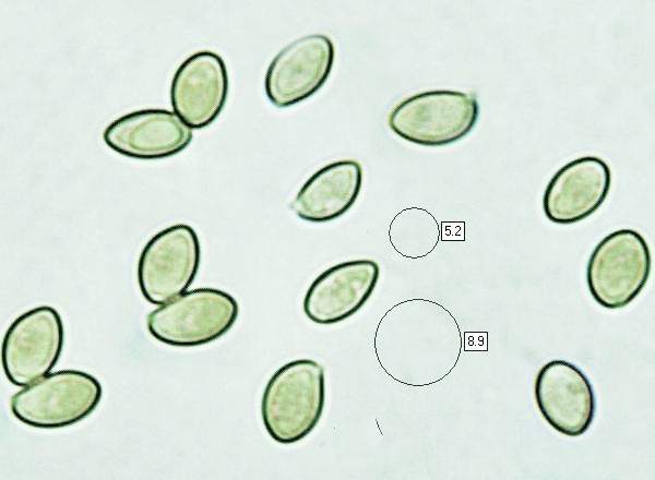 Spores of Inocybe geophylla var. lilacina
