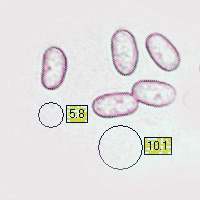 Spores of Inocybe rimosa, Torn Fibrecap