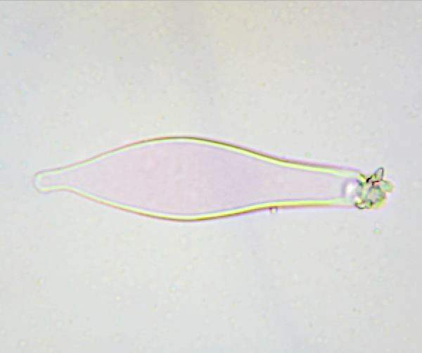 Pleurocystidia of Inocybe rimosa