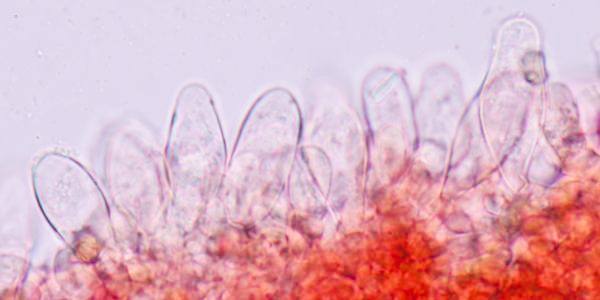 Spores of Inocybe stellatospora