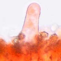 Pleuroocystidia of <em>Inocybe stellatospora</em>