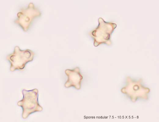 Spores of Inocybe stellatospora
