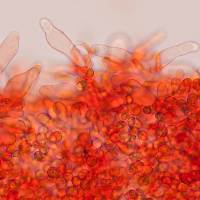 Cheilocystidia of <em>Tubaria conspersa</em>