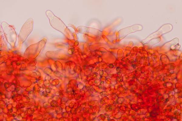Cheilocystidia of Tubaria conspersa