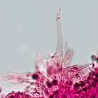 Cheilocystidia of Tubaria dispersa