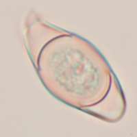 Chlamydospores of Asterophora parasitica
