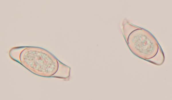 Ascospores of Asterophora parasitica