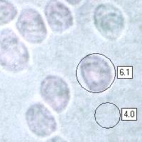 Spores of the White Domecap