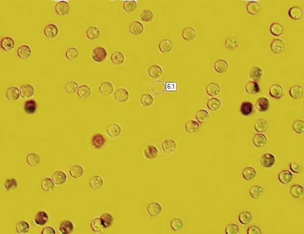 Spores of Lyophyllum decastes