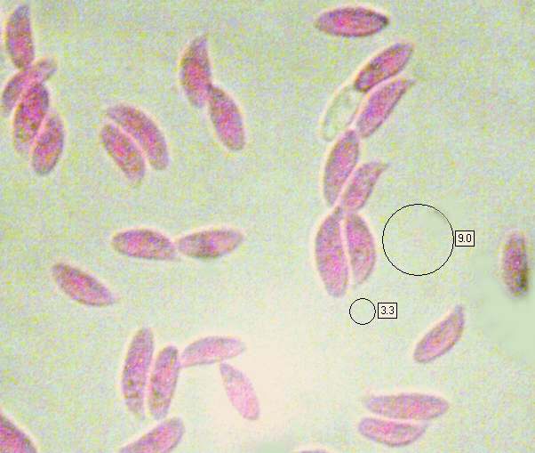 Spores of Gymnopus peronatus