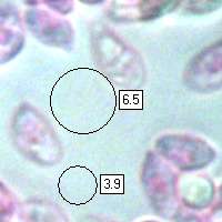 Spores of Marasmius wynneae