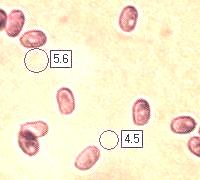 Spores of Omphalotus olearius