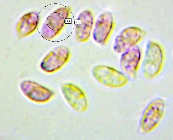Spores of Rhodocollybia butyracea