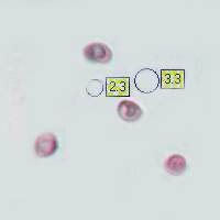 Spores and basidia of Meripilus giganteus