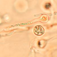 Clamidia of Abortiporus biennis, mature