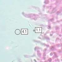 Closeup of fertile surface of Phlebia radiata, mature