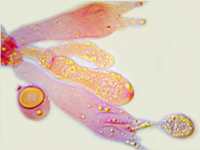 Basidia of Atheniella adonis