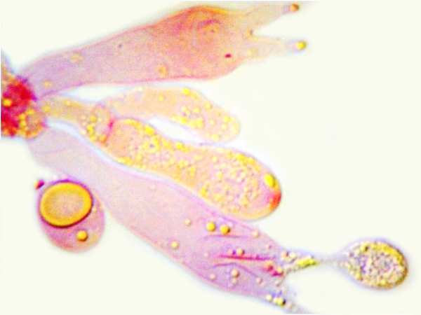 Basidia of Atheniella adonis