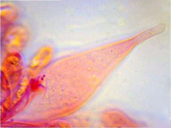 Cheilocystidia of Atheniella adonis